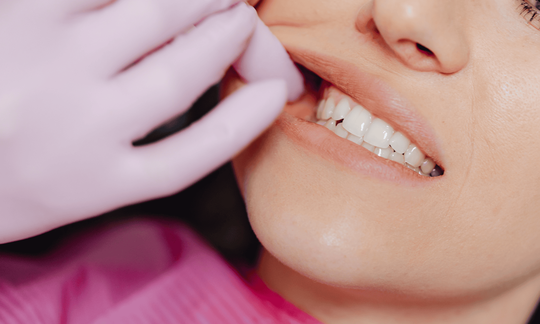 Implantes dentales en Turquía